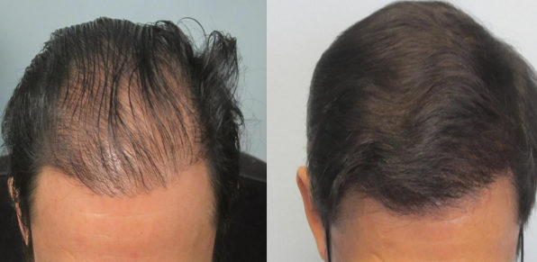PRP Capelli Como