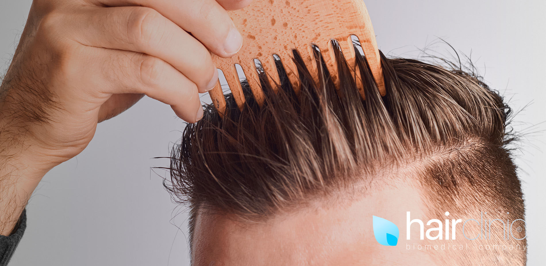trapianto-di-capelli-risultati-dopo-quanto
