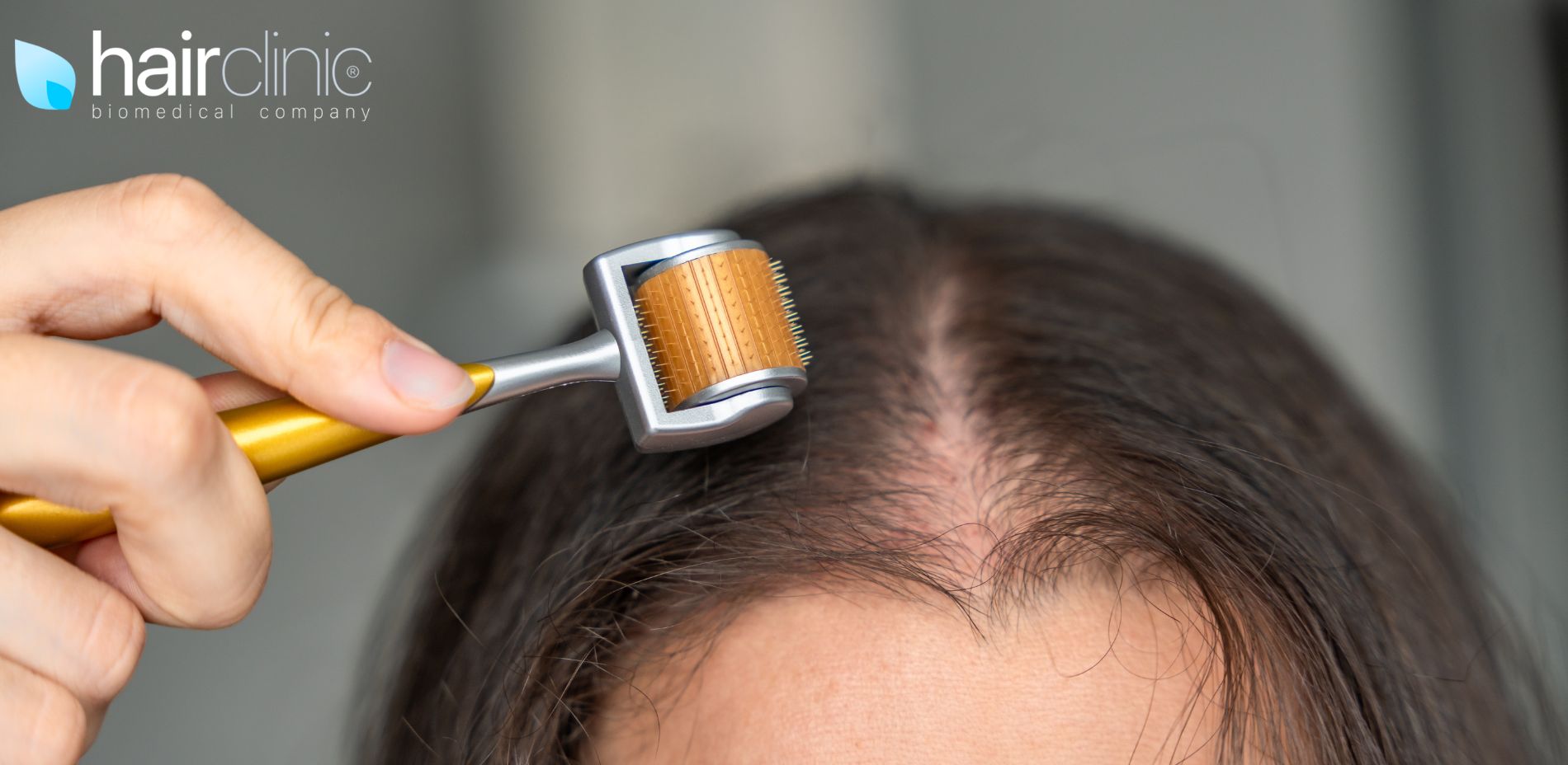 donna e il microneedling per capelli