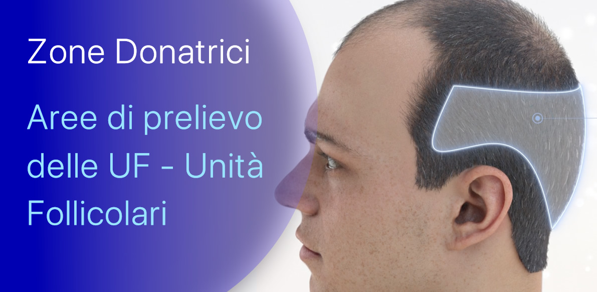 Zone Donatrici