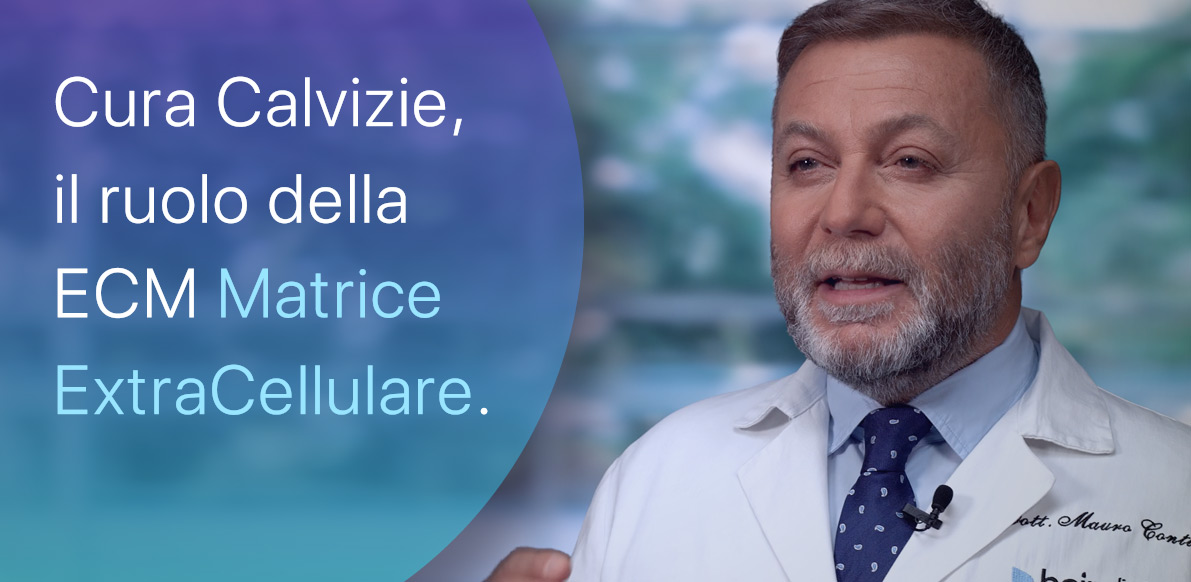 Matrice ExtraCellulare Nativa e Calvizie