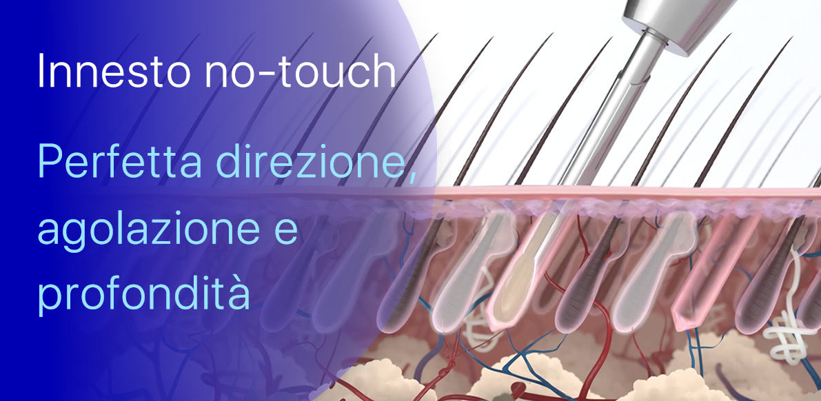 Innesto no-touch