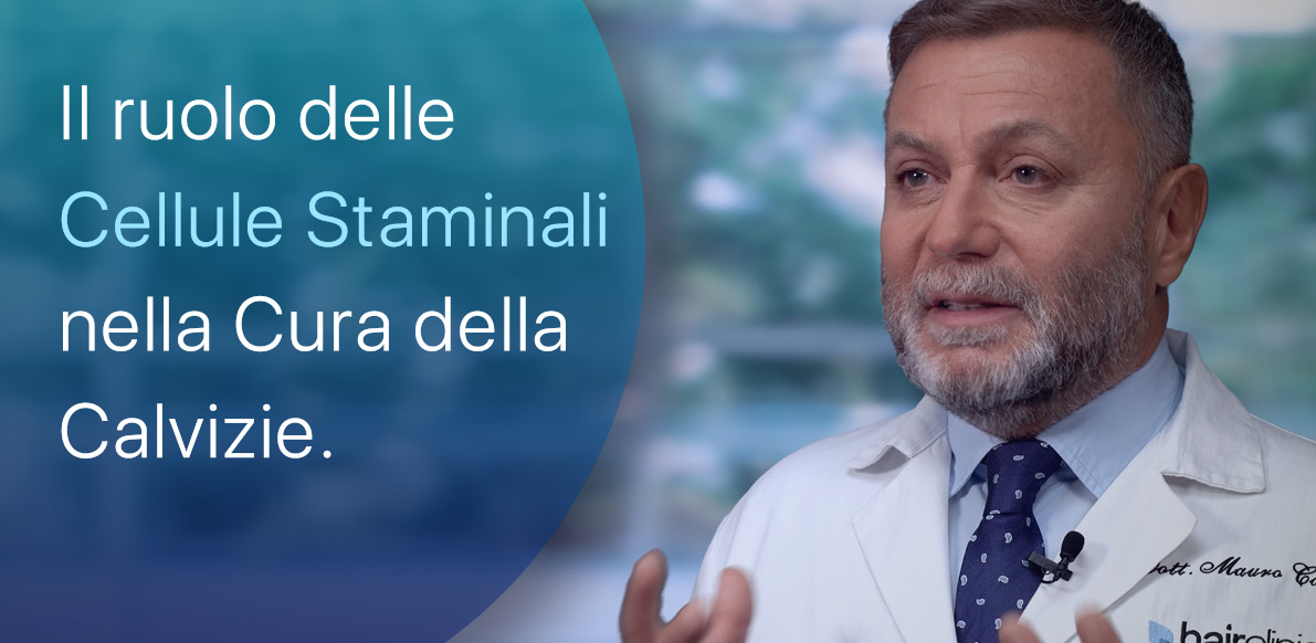 Cellule Staminali per la cura della Calvizie