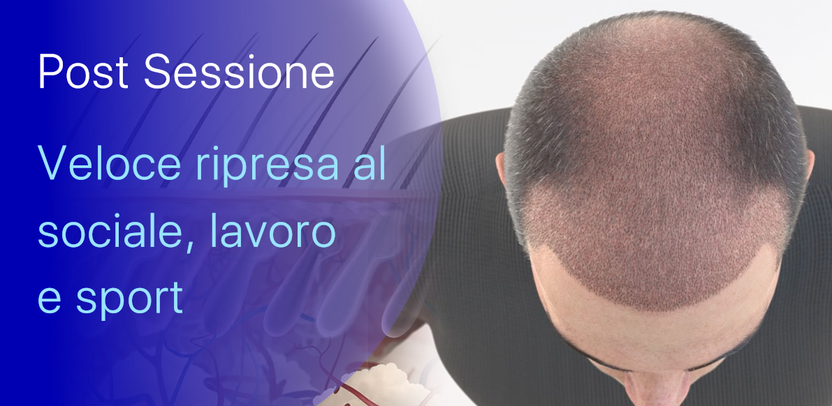 Post Sessione di atFUE