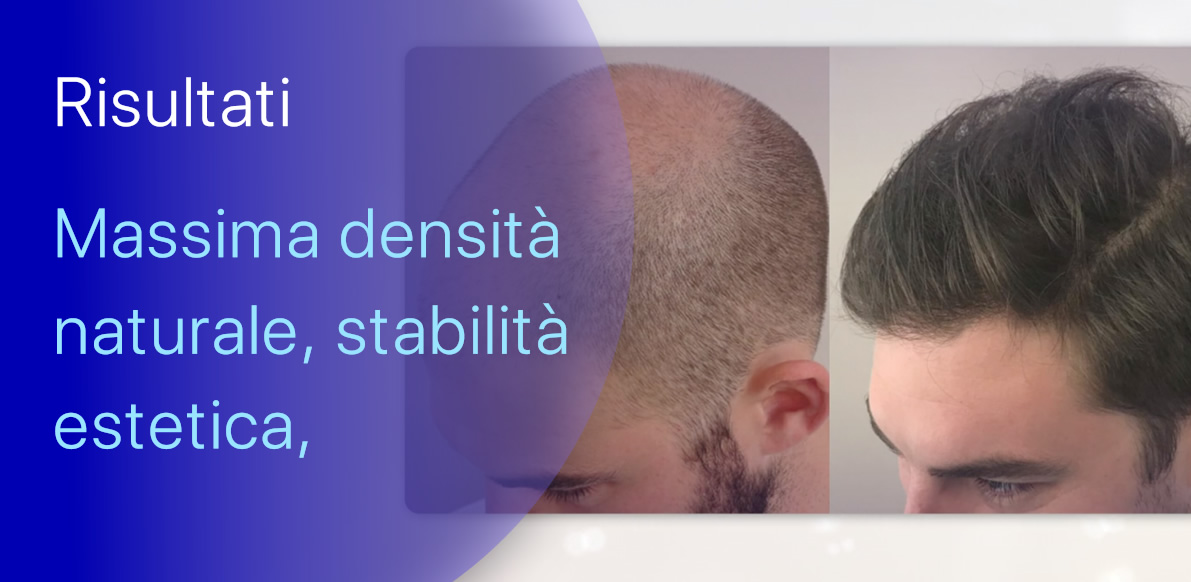 Massima Densità