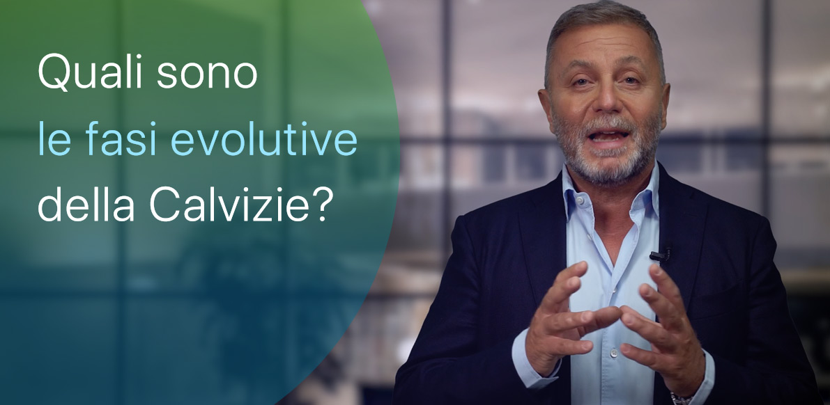 Come si evolve la Calvizie?