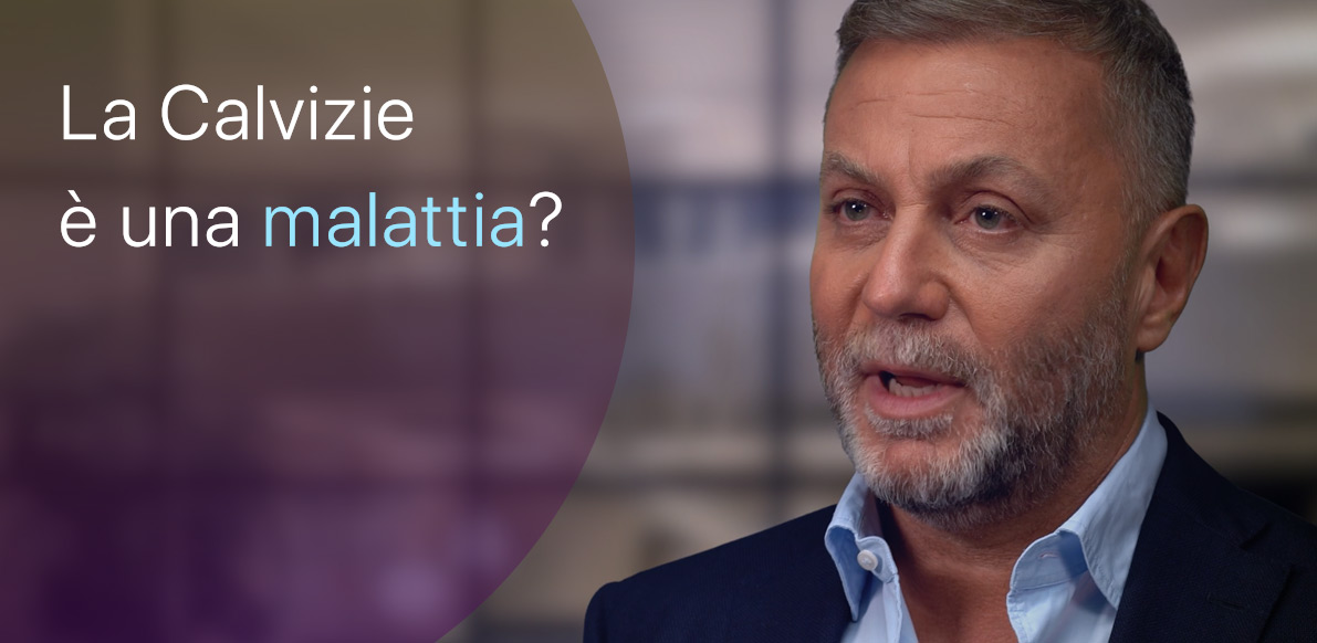 La Calvizie è da ritenersi una malattia?
