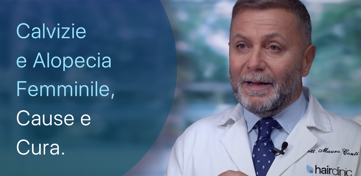 Calvizie e Alopecia Femminile
