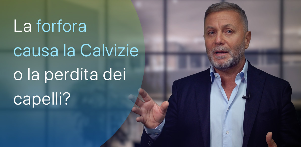 La forfora causa la perdita di capelli?