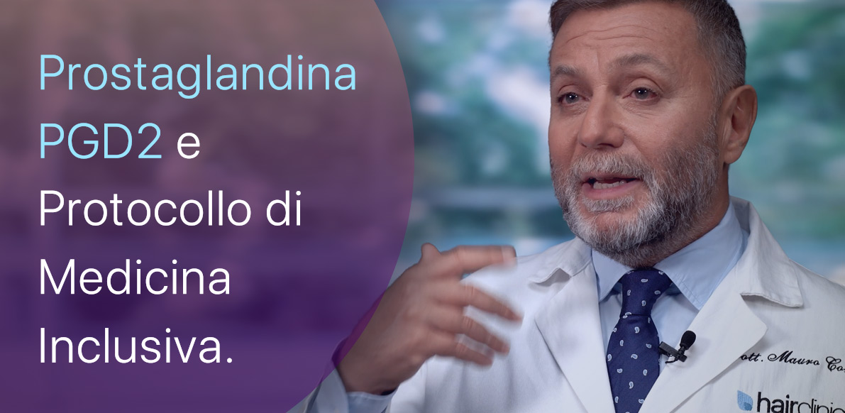 Prostaglandina PGD2 e Alopecia
