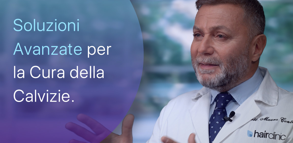 Calvizie e Soluzioni, non miracoli