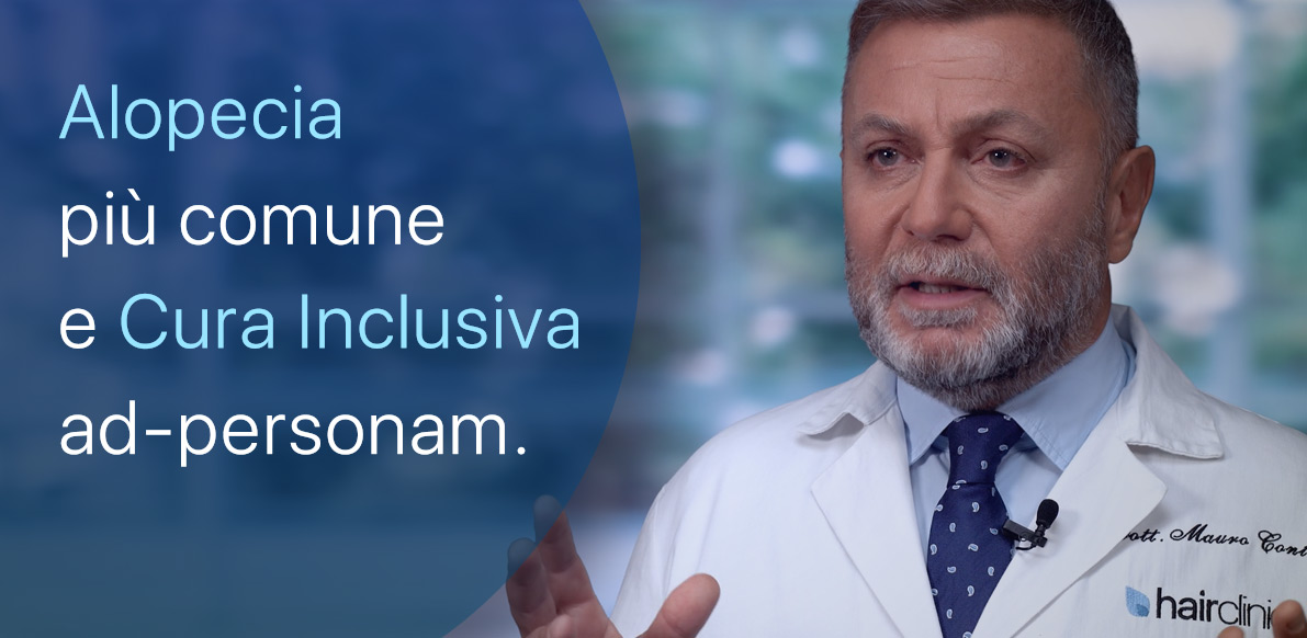 Alopecia Androgenetica e Terapia Inclusiva