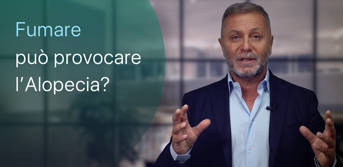Il fumo può causare l’Alopecia?
