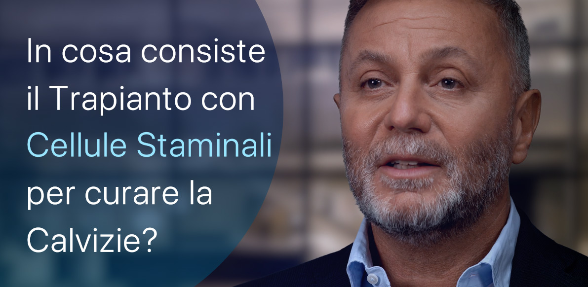 Le Cellule Staminali curano la Calvizie?