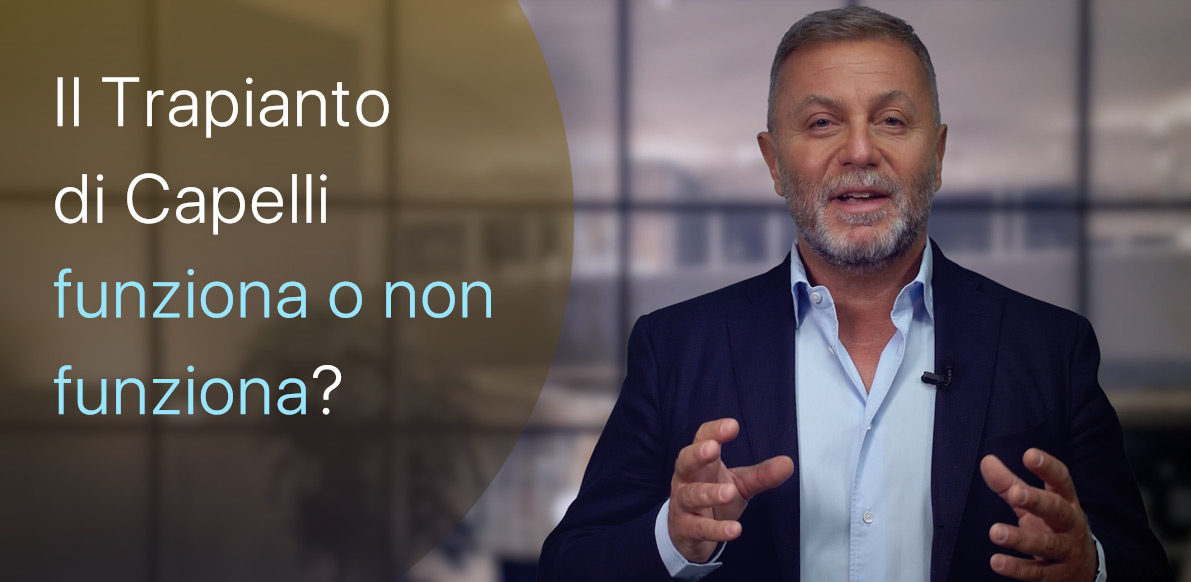 Il Trapianto di Capelli funziona si o no?