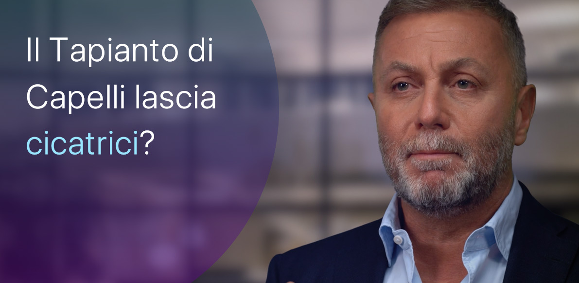 Quali cicatrici lascia un Trapianto di Capelli?