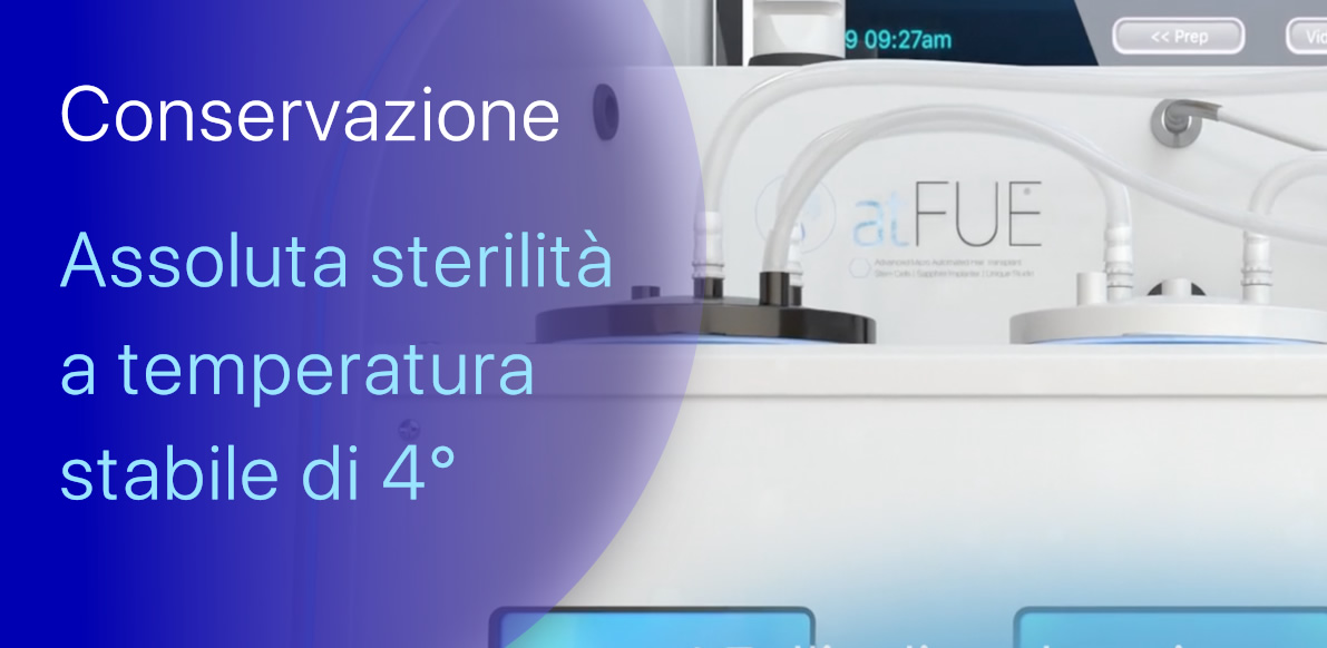 Conservazione delle UF