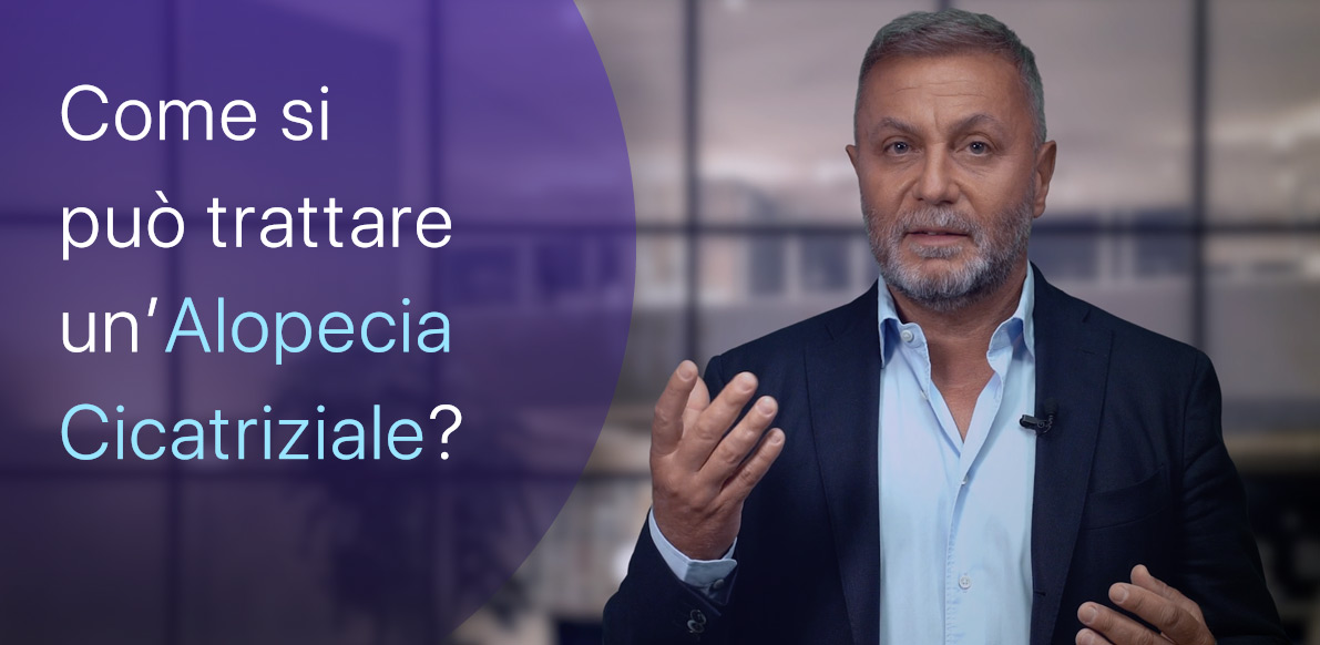 Come si cura l’Alopecia Cicatriziale?