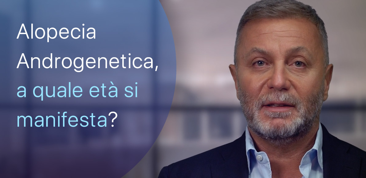 A quale età si manifesta l’Alopecia Androgenetica?