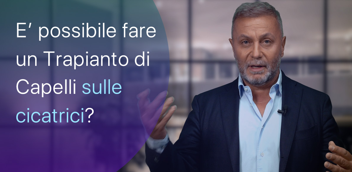 È possibile fare un Trapianto di Capelli sulle cicatrici?