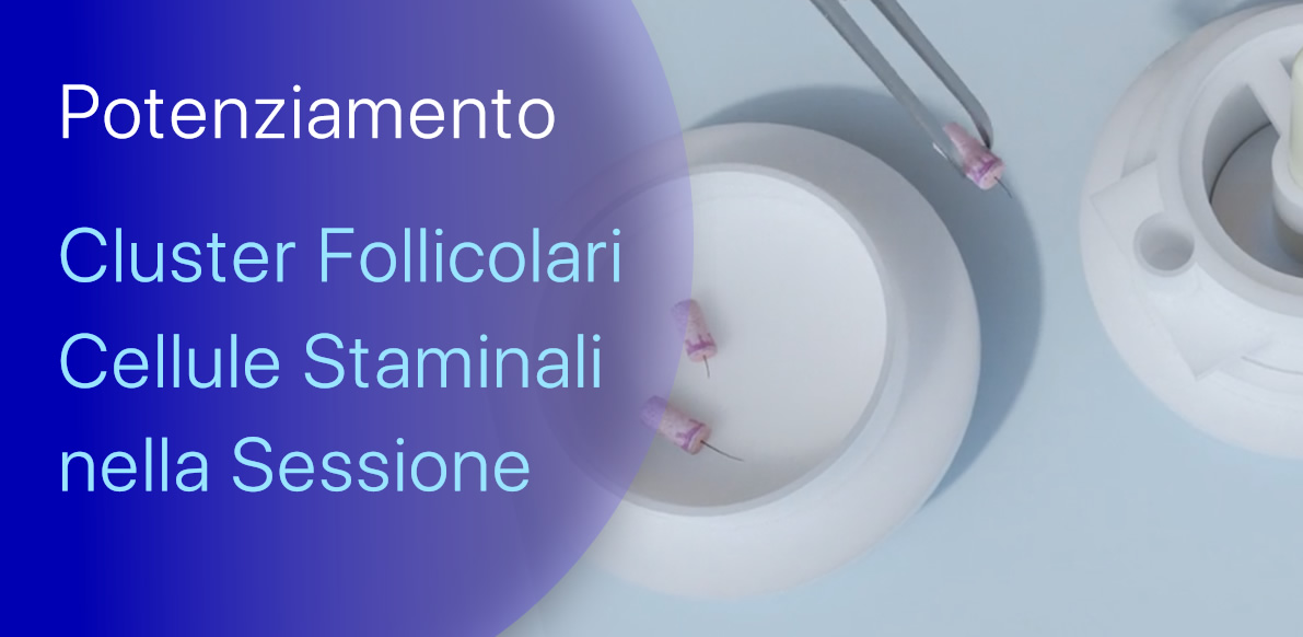 Il Potenziamento che mancava