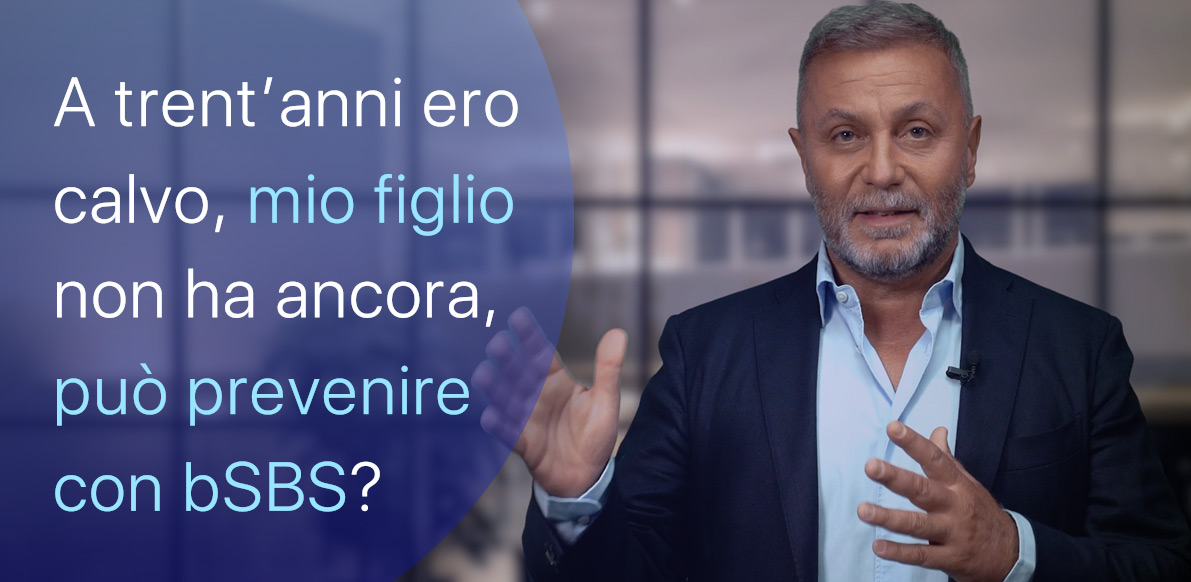 A trent’anni ero già calvo, mio figlio può evitarlo?