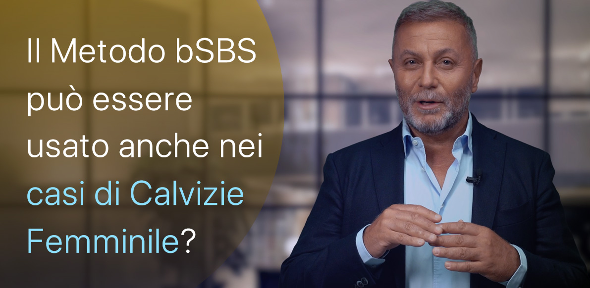 Nella Calvizie Femminile si può usare il metodo bSBS?