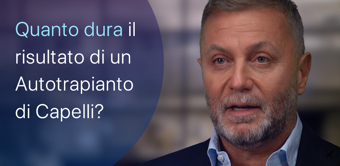 Quanto dura il risultato di un Autotrapianto di Capelli?