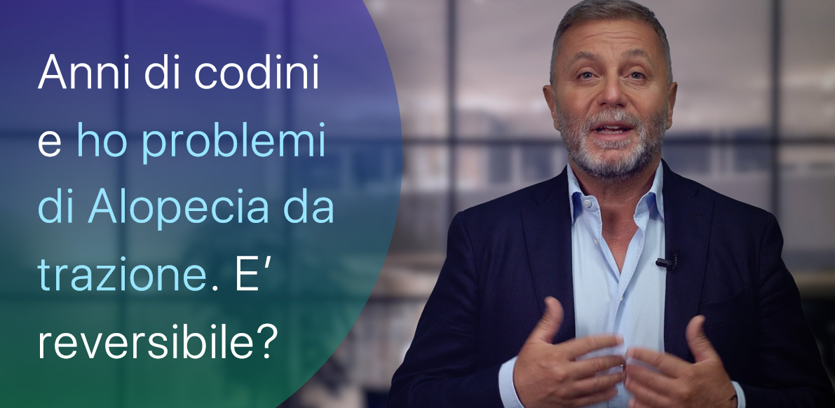 Alopecia da Trazione, è colpa di anni di codini?