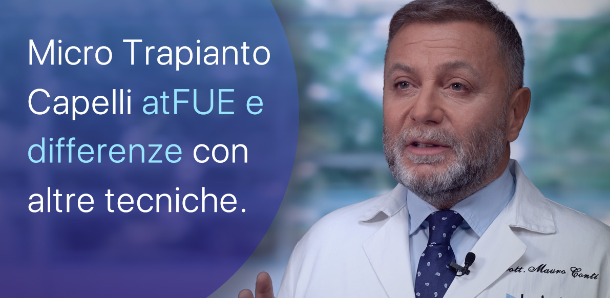 atFUE, differenze con altre tecniche