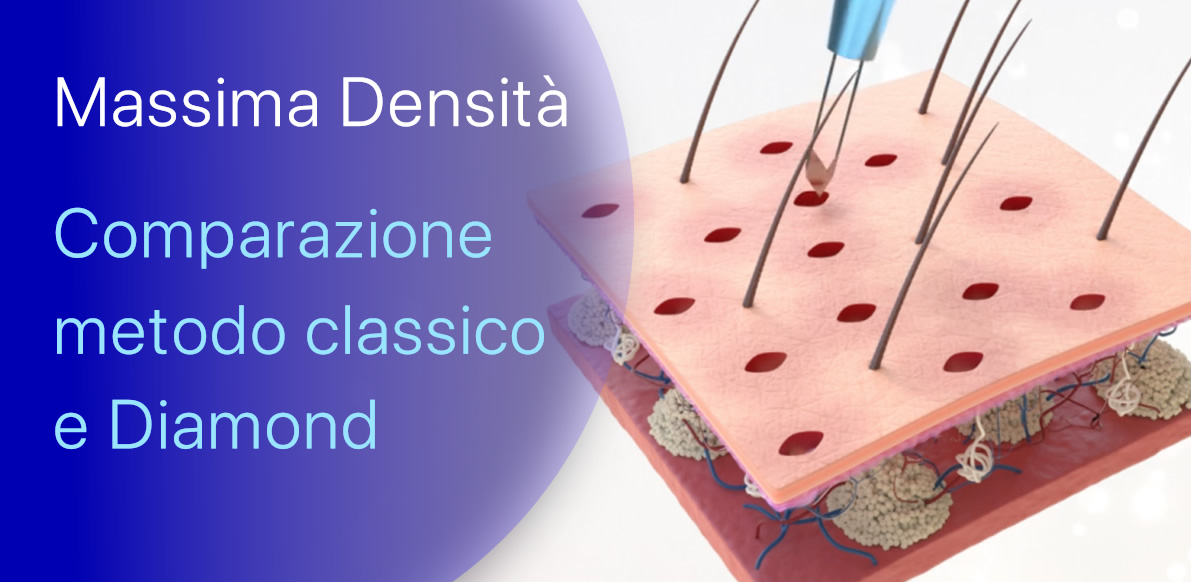 Più canali, più densità!