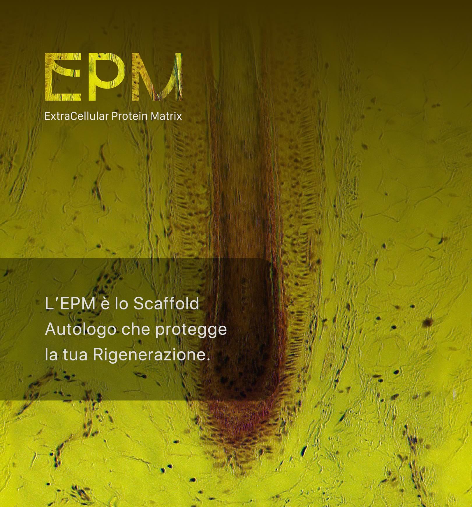EPM, ExtraCellular Protein Matrix
