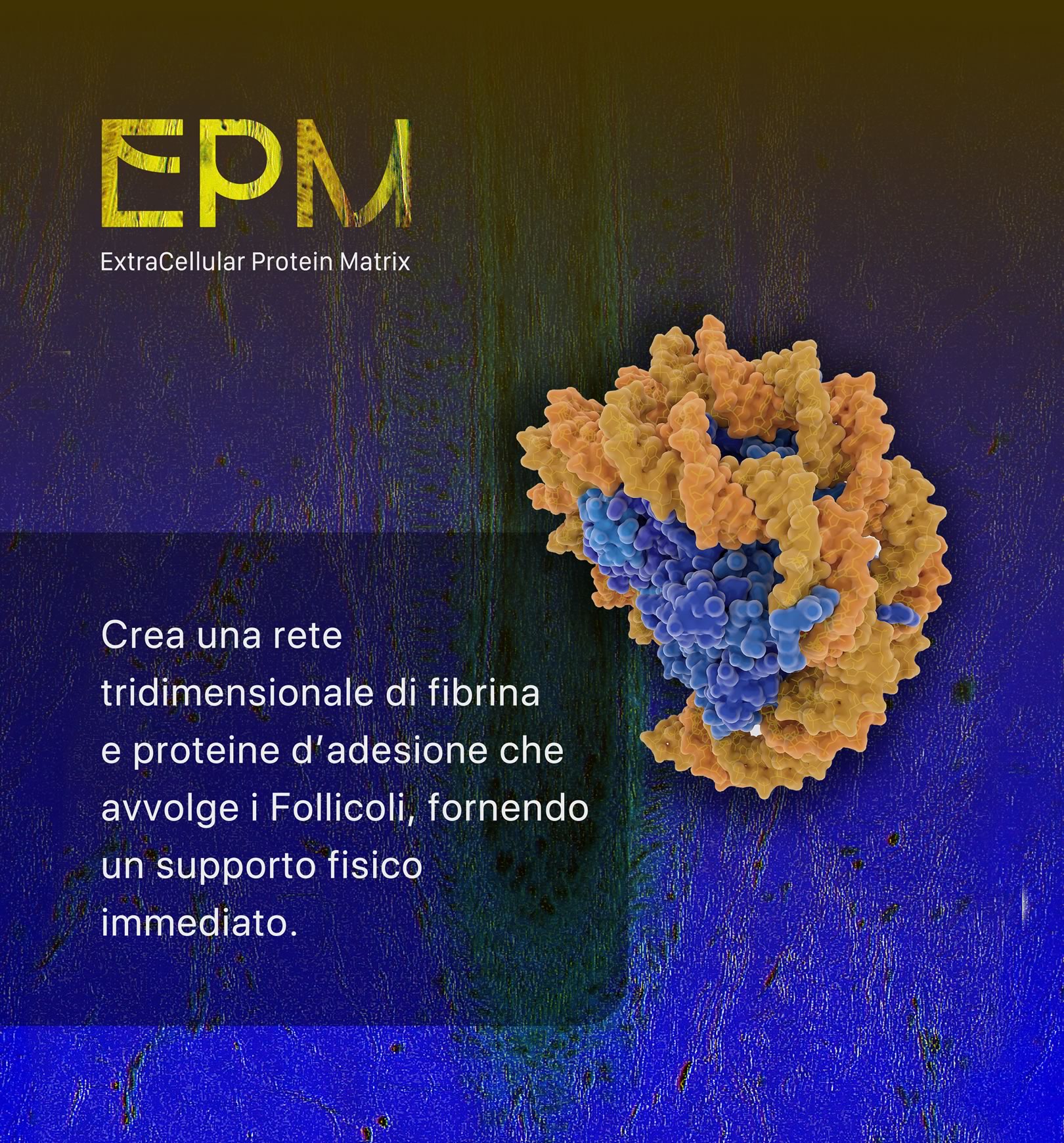 EPM, ExtraCellular Protein Matrix