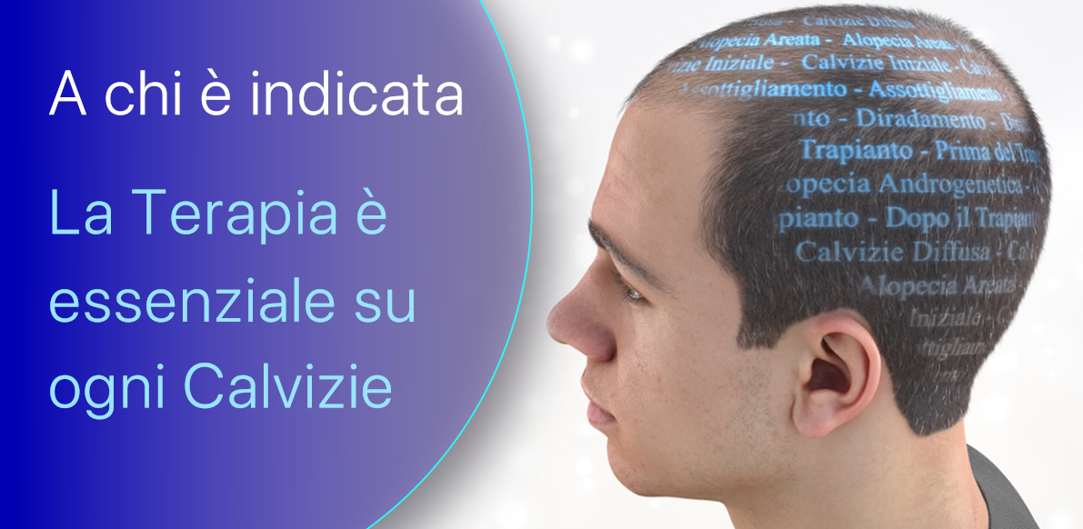 Come agire