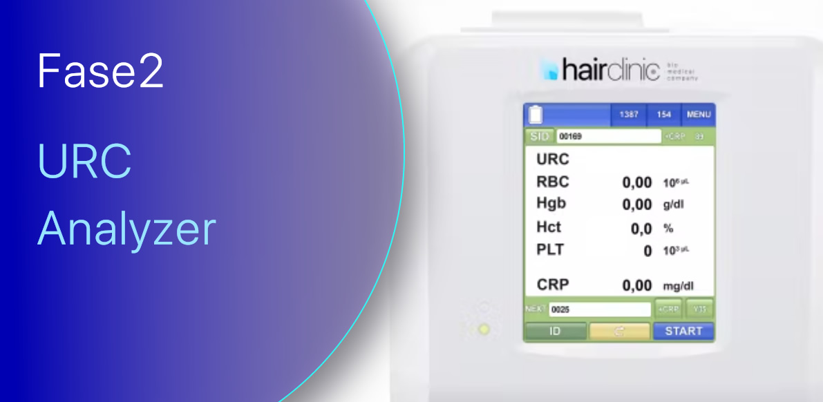 Fase 2 | URC Analyzer