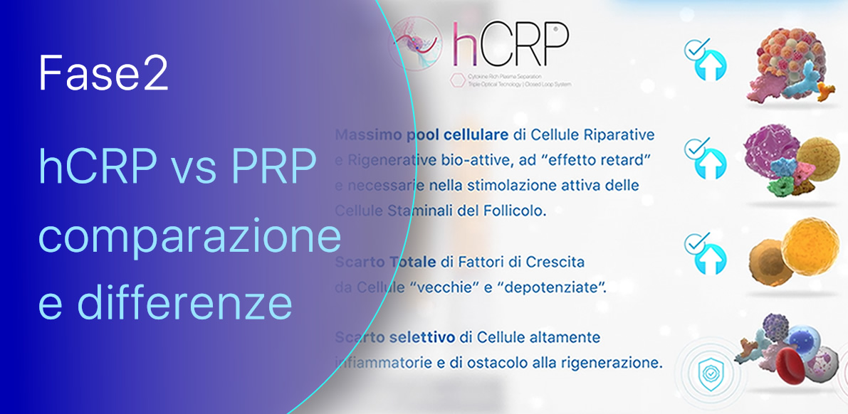 Fase 2 | Ricostruzione dell’Ambiente Follicolare