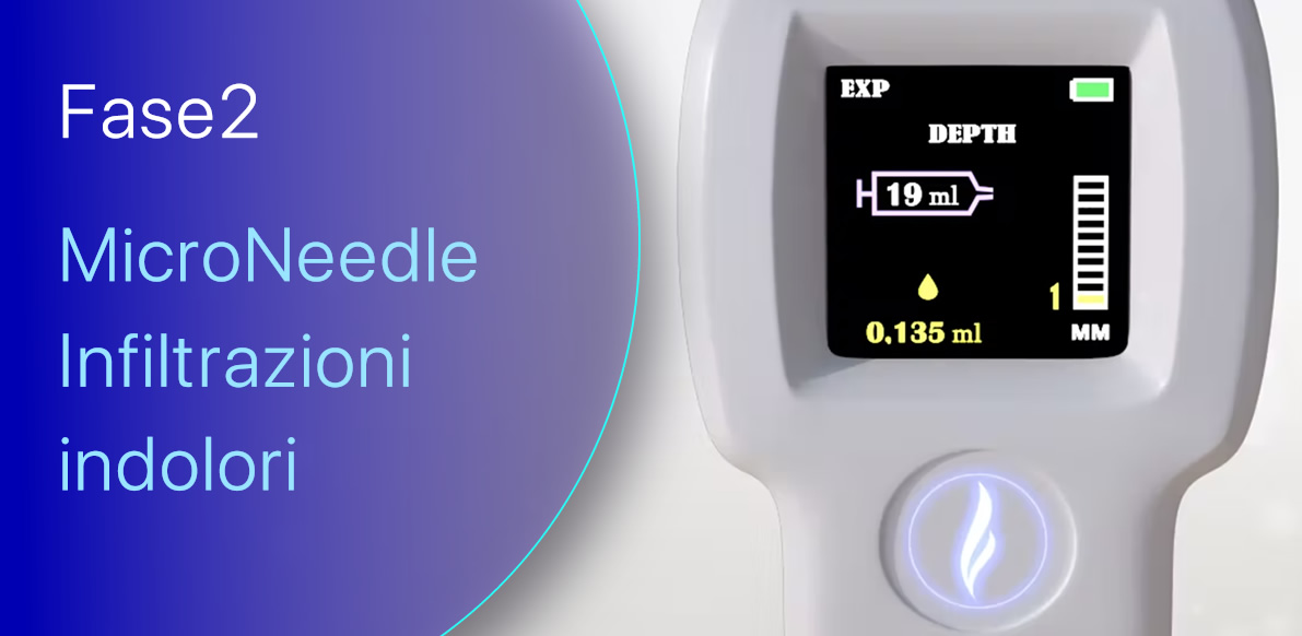 Fase2 | Infiltrazioni calibrate e indolori