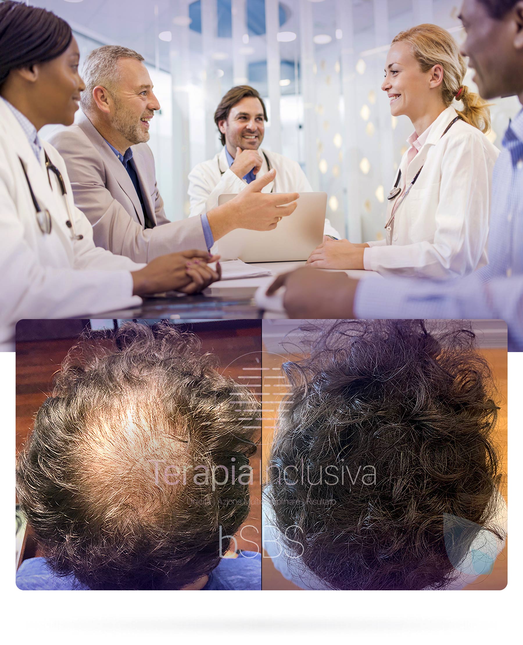 Medici e consulenti HairClinic a confronto; sotto, il prima e dopo di un Paziente con la scritta Terapia Inclusiva bSBS.