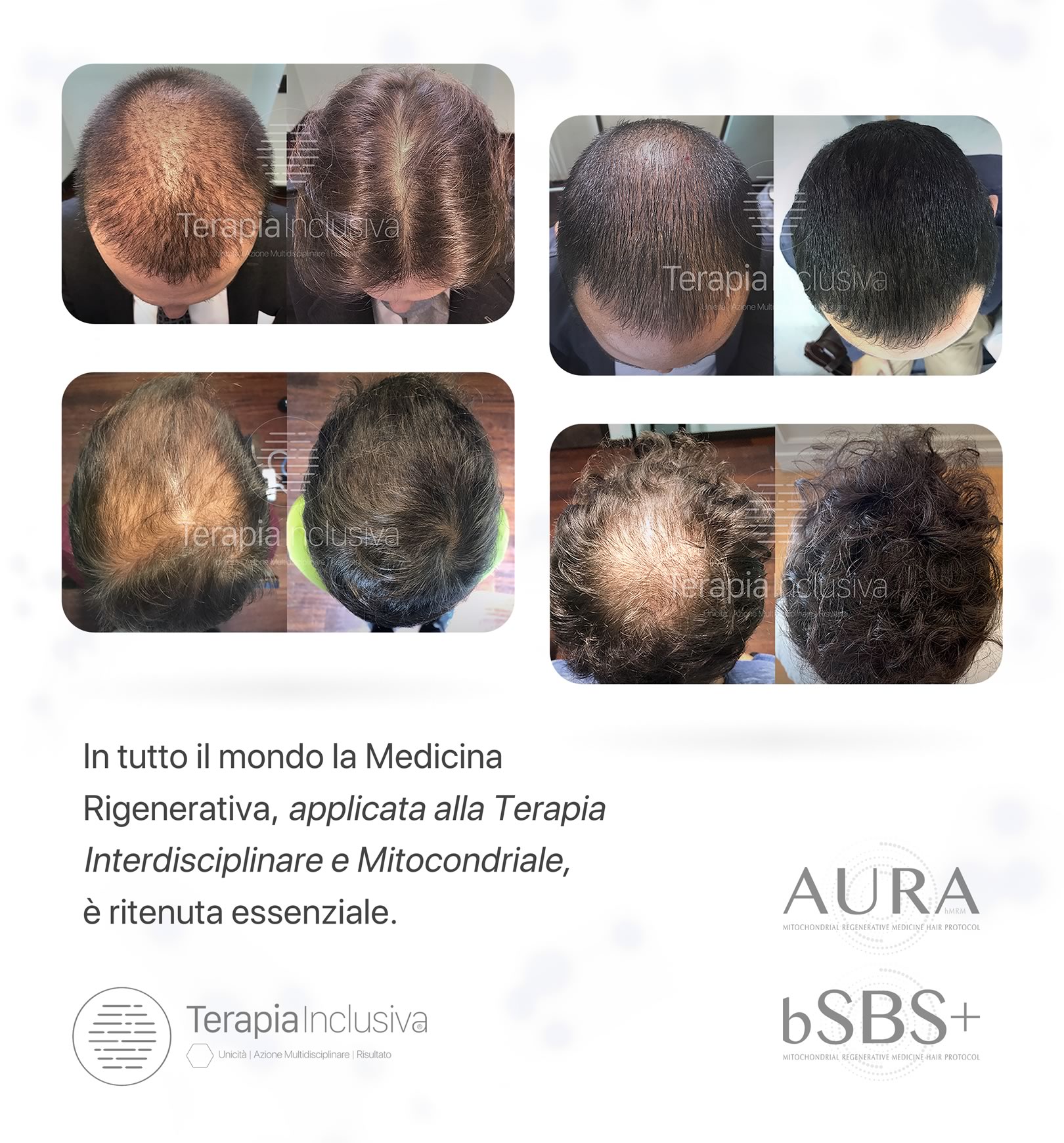 Risultati della Terapia Inclusiva bSBS e AURA