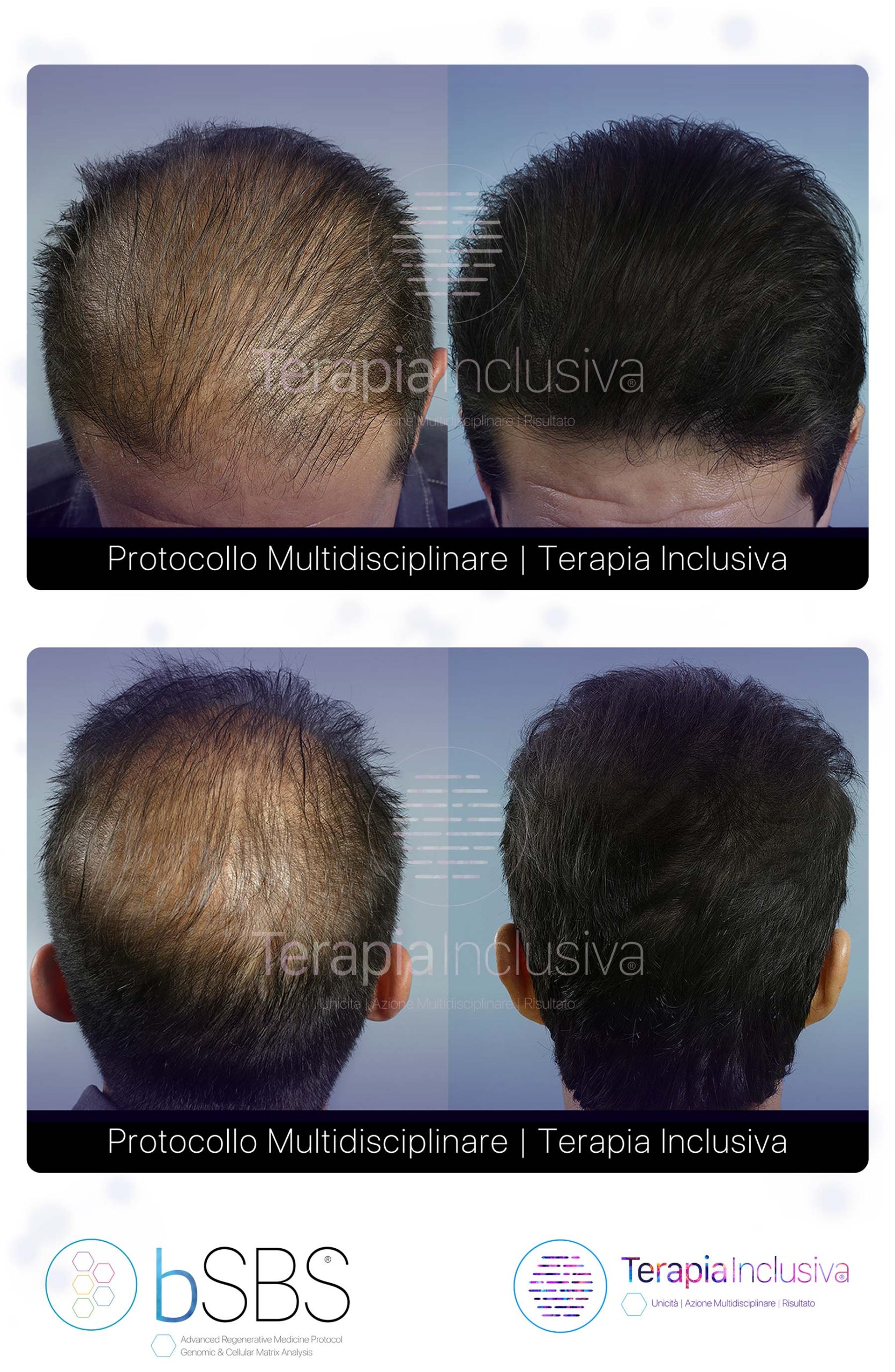Risultati della Terapia Inclusiva