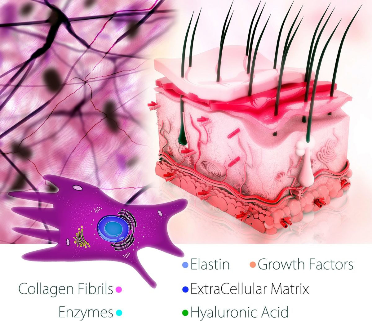 Fibroblasti e Cura Calvizie