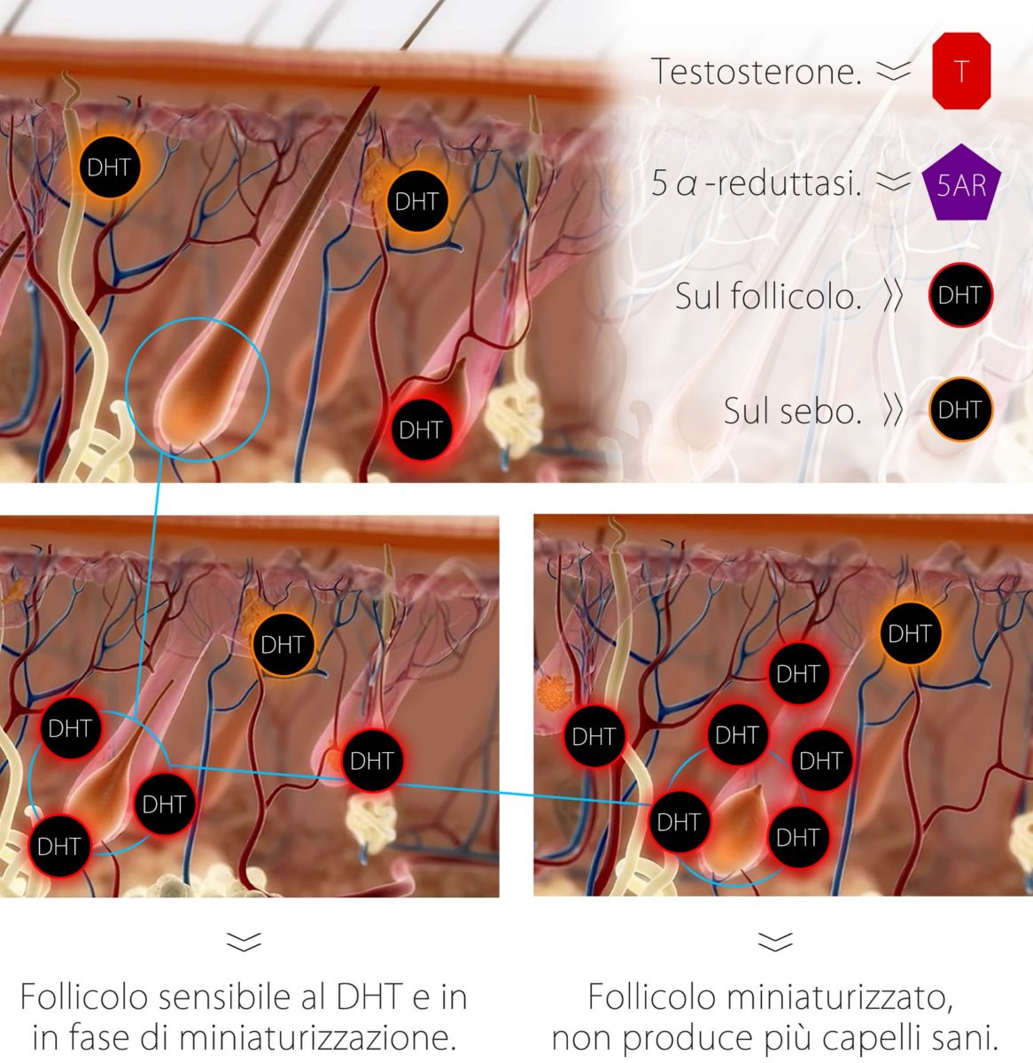 Cura Calvizie,, Finasteride e Dutasteride,