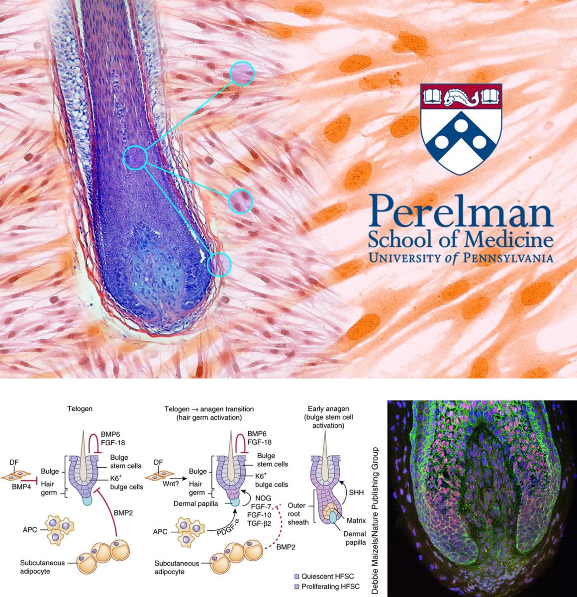 Fibroblasti e Cura Calvizie