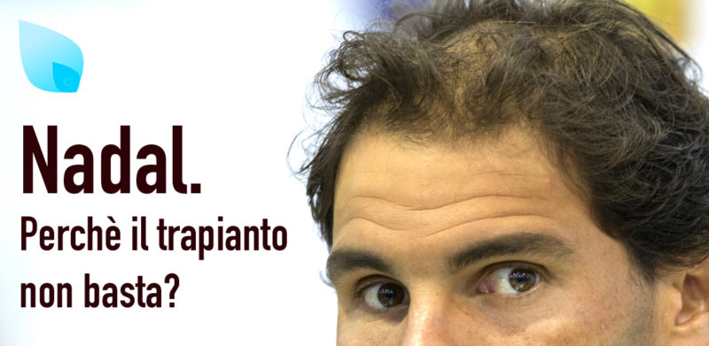 Nadal Trapianto Capelli