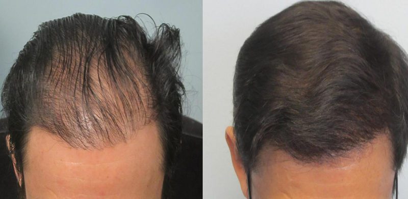 PRP Capelli Como