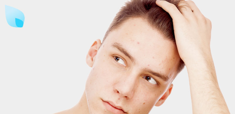 Finasteride e Impotenza?