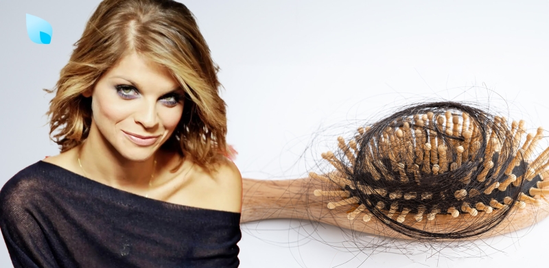 alopecia-da-stress-alessandra-amoroso-sintomi-cause-rimedi-cura