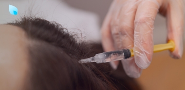 trattamenti-non-chirurgici-capelli-diradati
