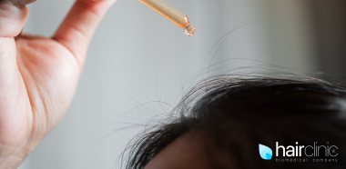 donna che somministra un siero sul cuoio capelluto