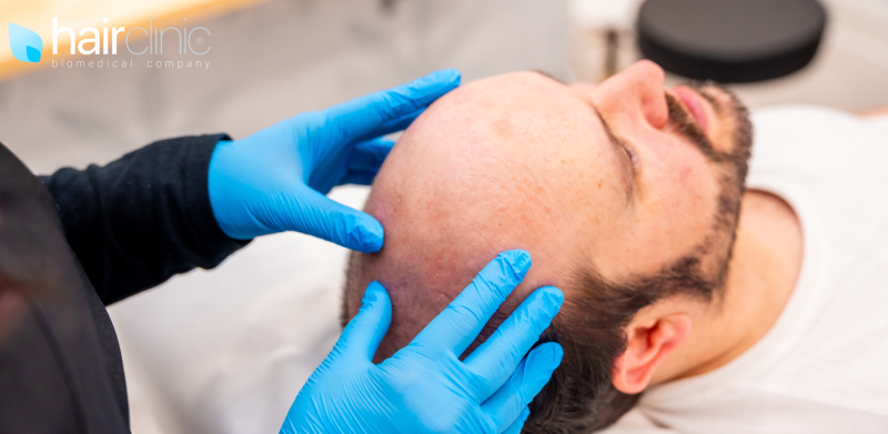 uomo che si sottopone ad un controllo medico per la calvizie